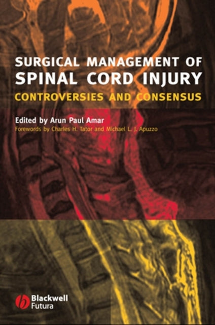 Surgical Management of Spinal Cord Injury: Controversies and Consensus