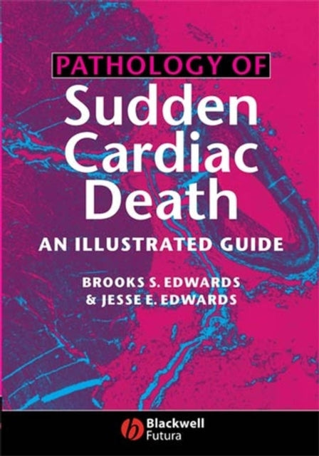 Pathology of Sudden Cardiac Death: An Illustrated Guide