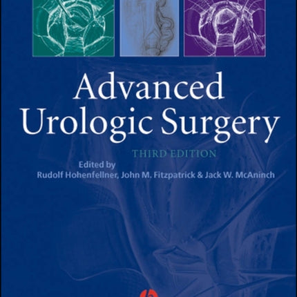 Advanced Urologic Surgery