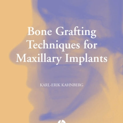 Bone Grafting Techniques for Maxillary Implants