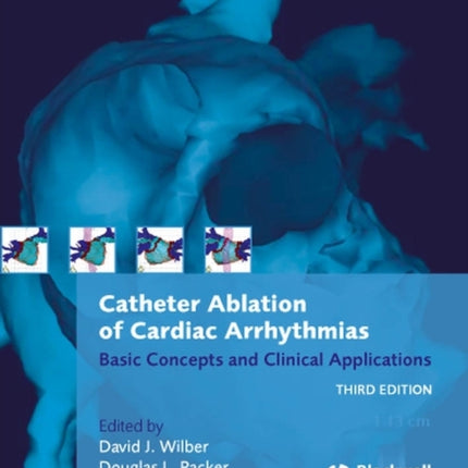 Catheter Ablation of Cardiac Arrhythmias