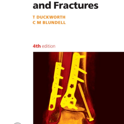 Orthopaedics and Fractures