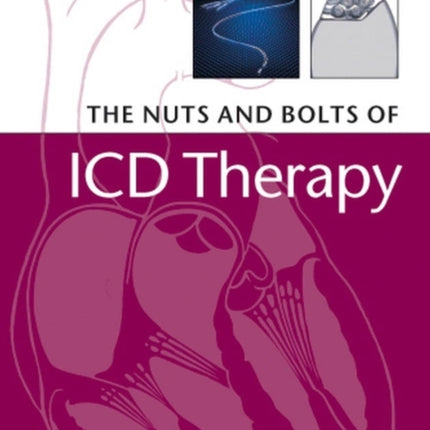 The Nuts and Bolts of ICD Therapy