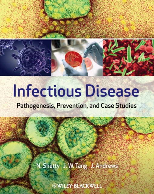 Infectious Disease: Pathogenesis, Prevention and Case Studies