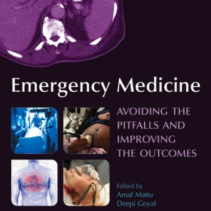 Emergency Medicine: Avoiding the Pitfalls and Improving the Outcomes