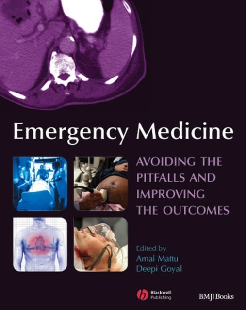 Emergency Medicine: Avoiding the Pitfalls and Improving the Outcomes