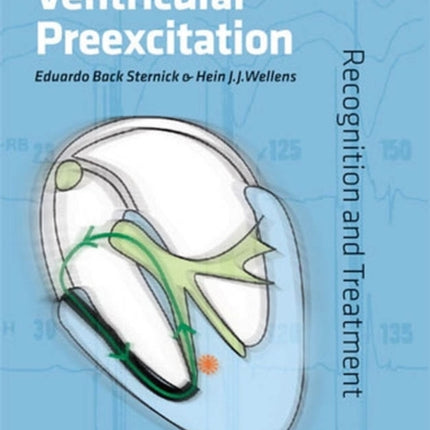 Variants of Ventricular Preexcitation