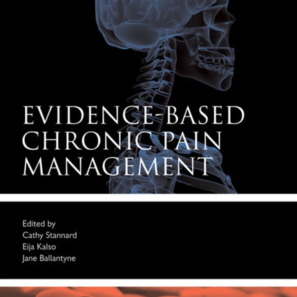 EvidenceBased Chronic Pain Management