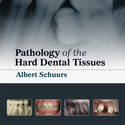 Pathology of the Hard Dental Tissues