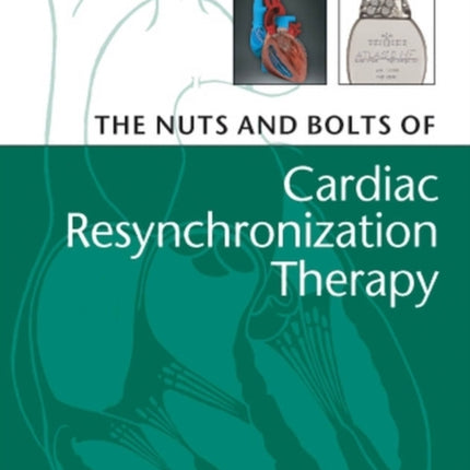 The Nuts and Bolts of Cardiac Resynchronization