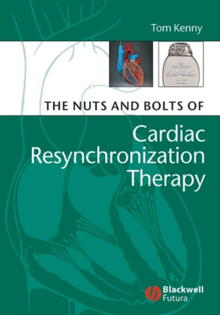 The Nuts and Bolts of Cardiac Resynchronization