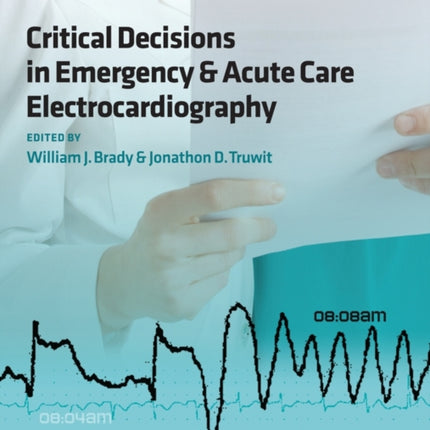 Critical Decisions in Emergency and Acute Care Electrocardiography