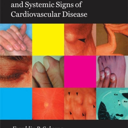 Color Atlas of Local and Systemic Manifestations of Cardiovascular Disease