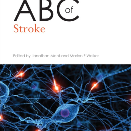 ABC of Stroke
