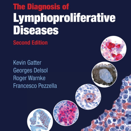 The Diagnosis of Lymphoproliferative Diseases