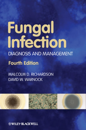 Fungal Infection: Diagnosis and Management