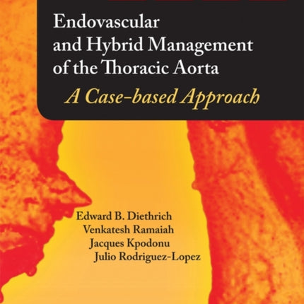 Endovascular and Hybrid Management of the Thoracic Aorta: A Case-based Approach