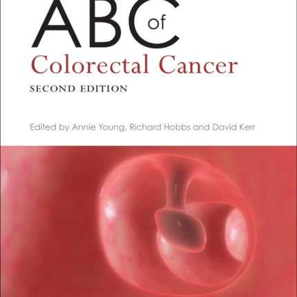 ABC of Colorectal Cancer