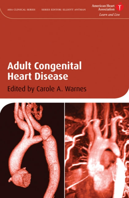 Adult Congenital Heart Disease