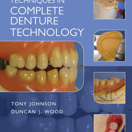 Techniques in Complete Denture Technology