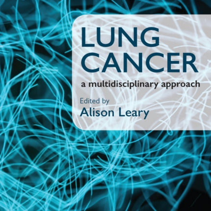 Lung Cancer: A Multidisciplinary Approach