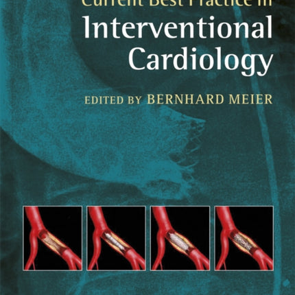 Current Best Practice in Interventional Cardiology