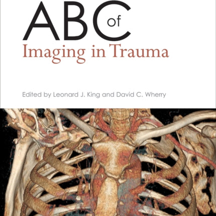 ABC of Imaging in Trauma