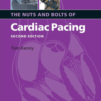 The Nuts and Bolts of Cardiac Pacing