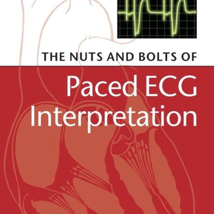 The Nuts and bolts of Paced ECG Interpretation