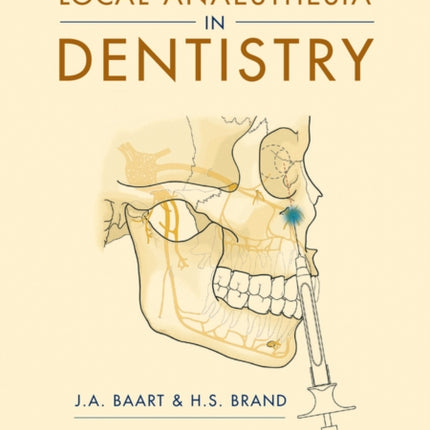 Local Anaesthesia in Dentistry
