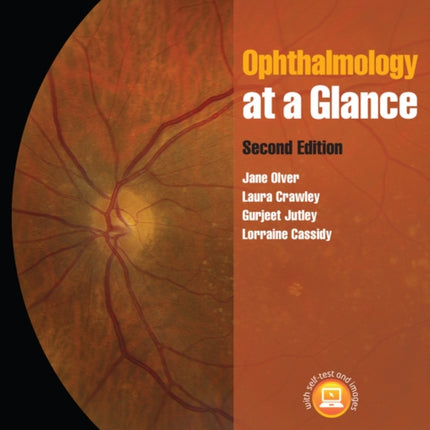 Ophthalmology at a Glance