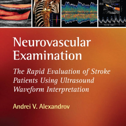 Neurovascular Examination: The Rapid Evaluation of Stroke Patients Using Ultrasound Waveform Interpretation