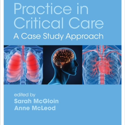 Advanced Practice in Critical Care