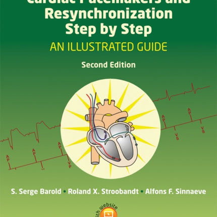 Cardiac Pacemakers and Resynchronization Step by Step: An Illustrated Guide