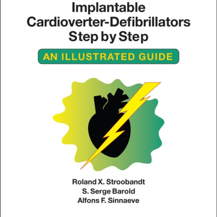 Implantable Cardioverter - Defibrillators Step by Step: An Illustrated Guide