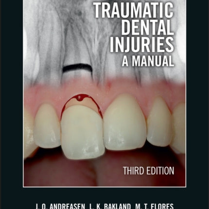 Traumatic Dental Injuries: A Manual