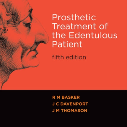 Prosthetic Treatment of the Edentulous Patient