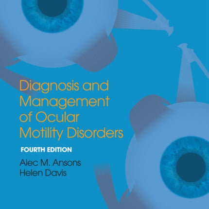 Diagnosis and Management of Ocular Motility Disorders