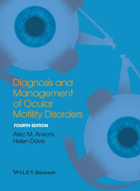 Diagnosis and Management of Ocular Motility Disorders