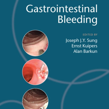 Gastrointestinal Bleeding