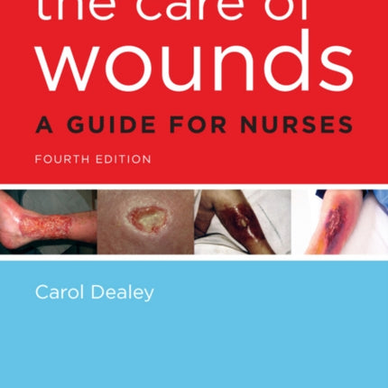 The Care of Wounds: A Guide for Nurses