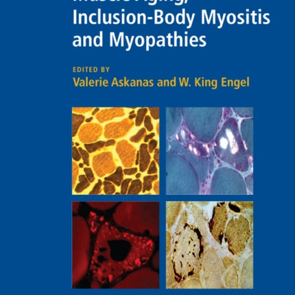 Muscle Aging, Inclusion-Body Myositis and Myopathies