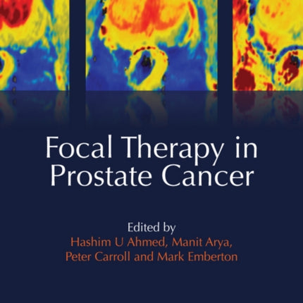 Focal Therapy in Prostate Cancer