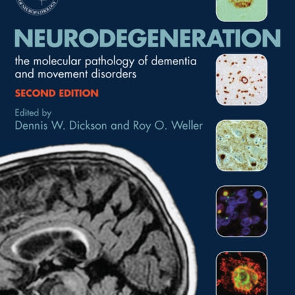 Neurodegeneration: The Molecular Pathology of Dementia and Movement Disorders