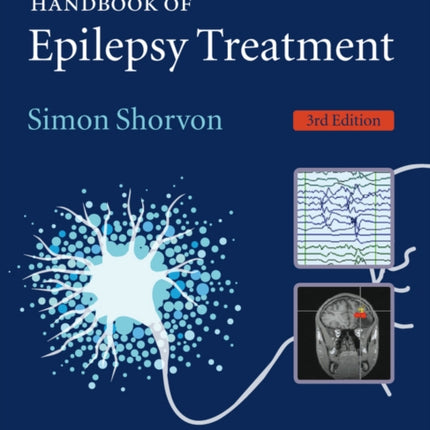 Handbook of Epilepsy Treatment