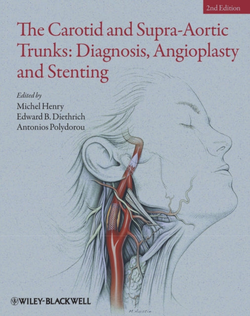 The Carotid and Supra-Aortic Trunks: Diagnosis, Angioplasty and Stenting