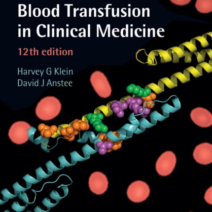 Mollisons Blood Transfusion in Clinical Medicine
