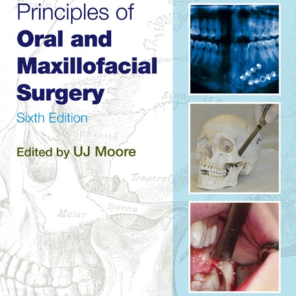 Principles of Oral and Maxillofacial Surgery