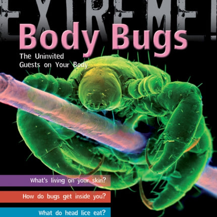 Extreme Science: Body Bugs!: The Uninvited Guests on Your Body