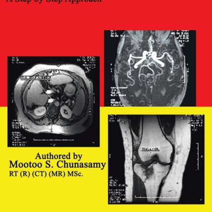 MRI Guide for Technologists A Step by Step Approach